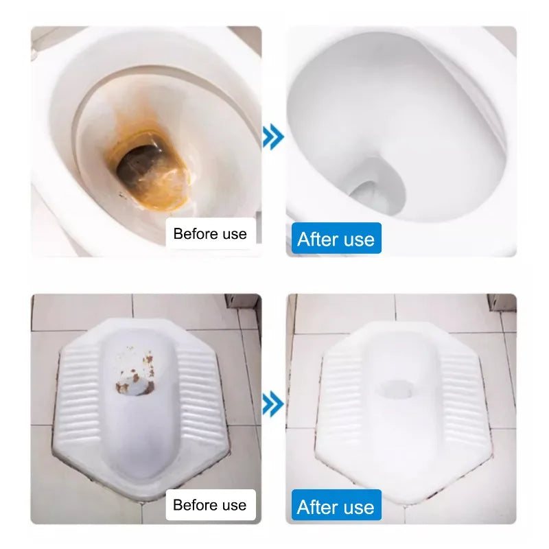 Toilet Cleaning Effervescent Tablets - Stain Remover & Deodorizer