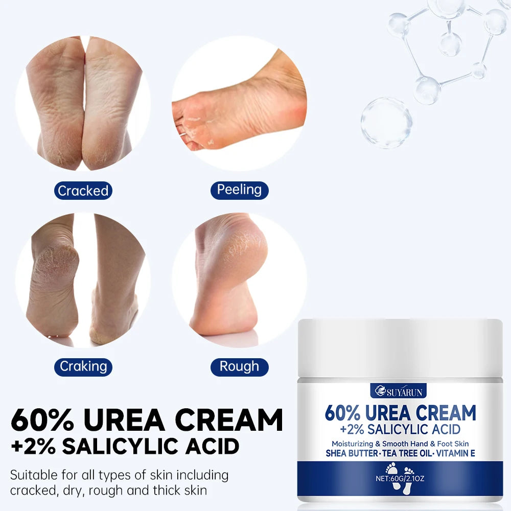 60% Urea Foot Cream - Intensive Treatment for Cracked Heels, Dry Feet & Calluses (100g)