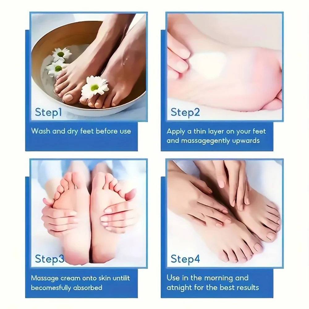 60% Urea Foot Cream - Intensive Treatment for Cracked Heels, Dry Feet & Calluses (100g)