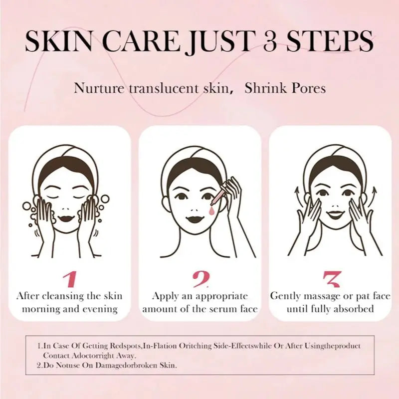 Niacinamide Serum 10% - Dark Spot Remover for Acne Marks & Hyperpigmentation (30ml)