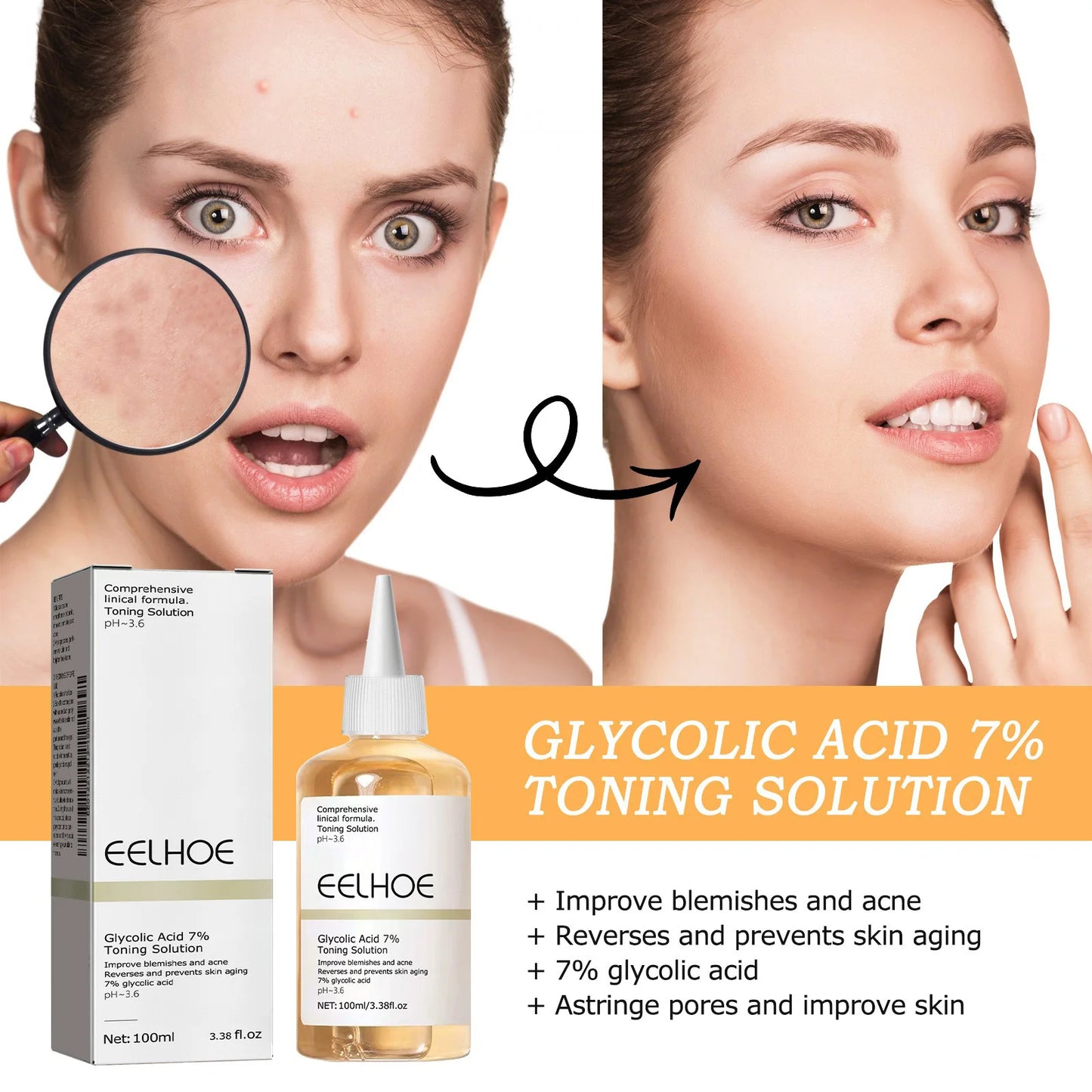 Glycolic Acid 7% Toning Solution - Exfoliating Toner for Acne & Anti-Aging (100ml)