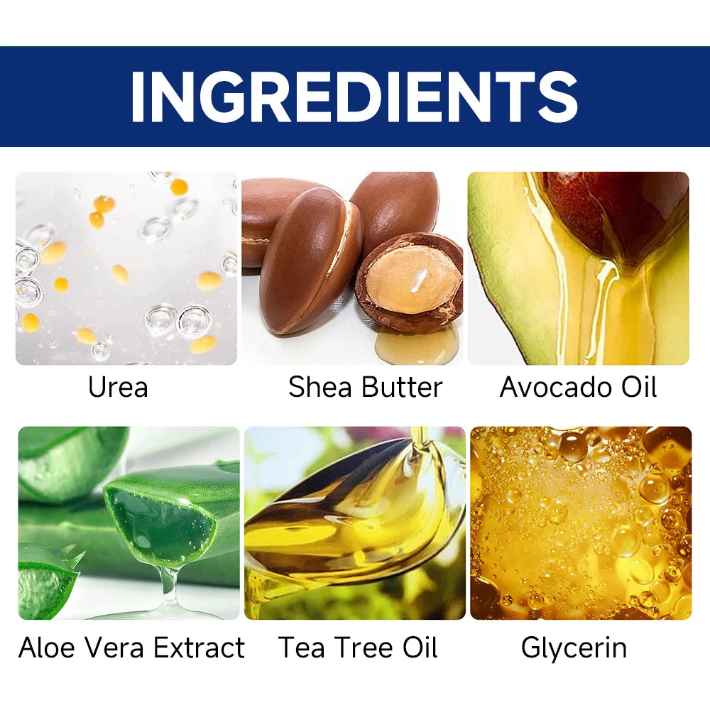 60% Urea Foot Cream - Intensive Treatment for Cracked Heels, Dry Feet & Calluses (100g)