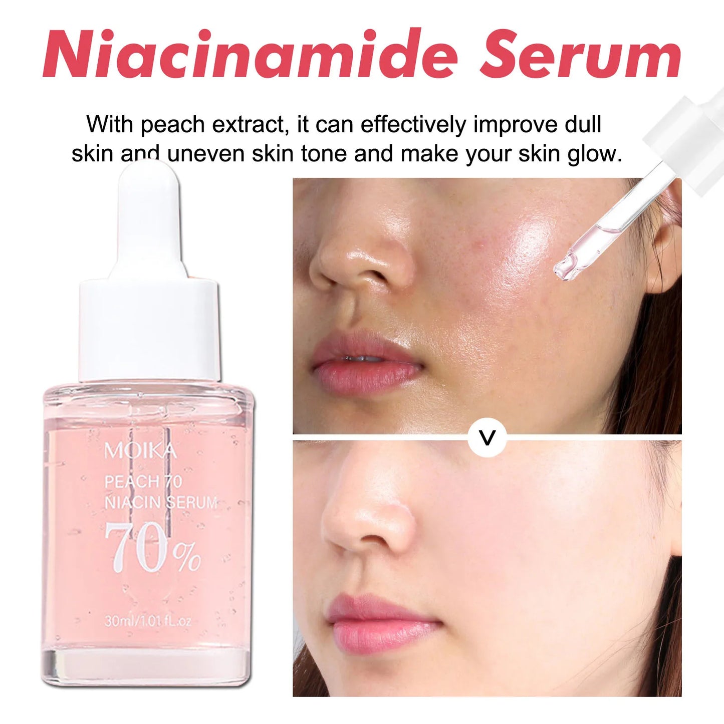 Niacinamide Serum 10% - Dark Spot Remover for Acne Marks & Hyperpigmentation (30ml)